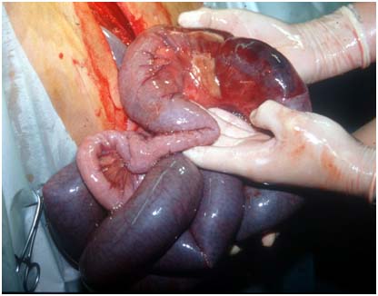 Darmst�ck mit h�morrhagisch infarzierter Damwand vor der Massage