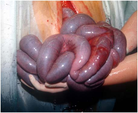 Darmst�ck mit h�morrhagisch infarzierter Damwand nach der Massage